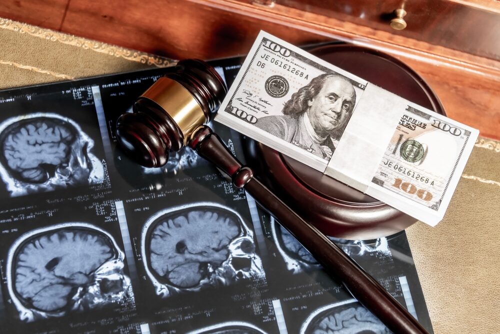 Are Personal Injury Settlements Taxable in Minnesota?